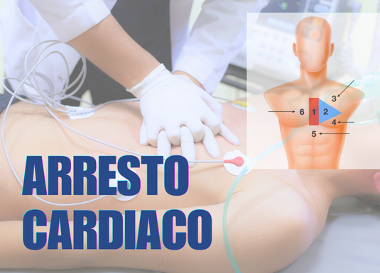 ARRESTO CARDIACO E COMPRESSIONI TORACICHE: DOVE?