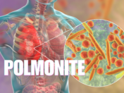 COSA CAMBIA NELLA GESTIONE DELLA POLMONITE ACQUISITA in COMUNITÀ nel 2025?