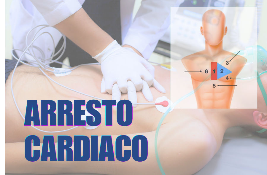 ARRESTO CARDIACO E COMPRESSIONI TORACICHE: DOVE?